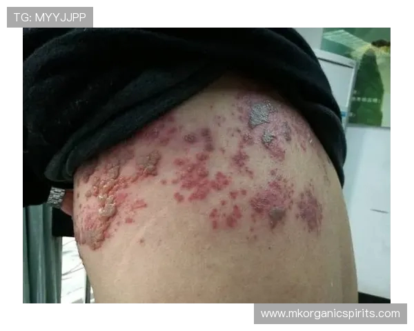 克洛泽谈执教压力：只要没有长疱疹就说明我还应对得了